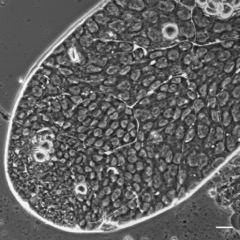 Apical testis