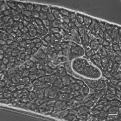 Median testis