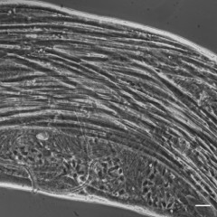 Distal testis